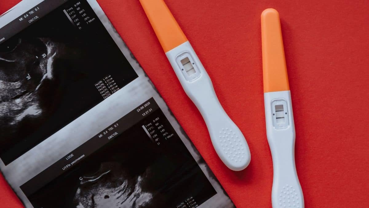 World IVF Day 2026: Can you really have twins with IVF? Doctor explains