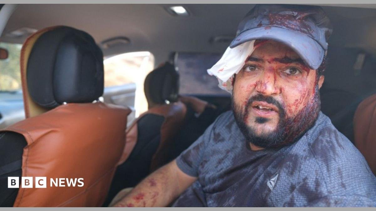 Palestinians and US journalist injured by Israeli settlers in West Bank harvest attack